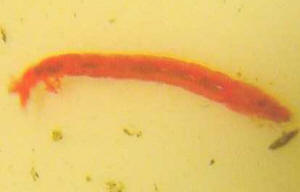 The mystery of bloodworm “copper” fangs solved